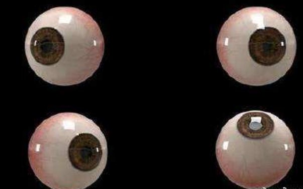 世界首個(gè)3D人工眼球問(wèn)世，數百萬(wàn)人將重見(jiàn)光明